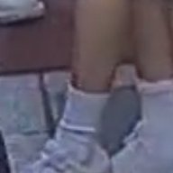 am i seeing things or was that a bandaid or smth on byul's legs