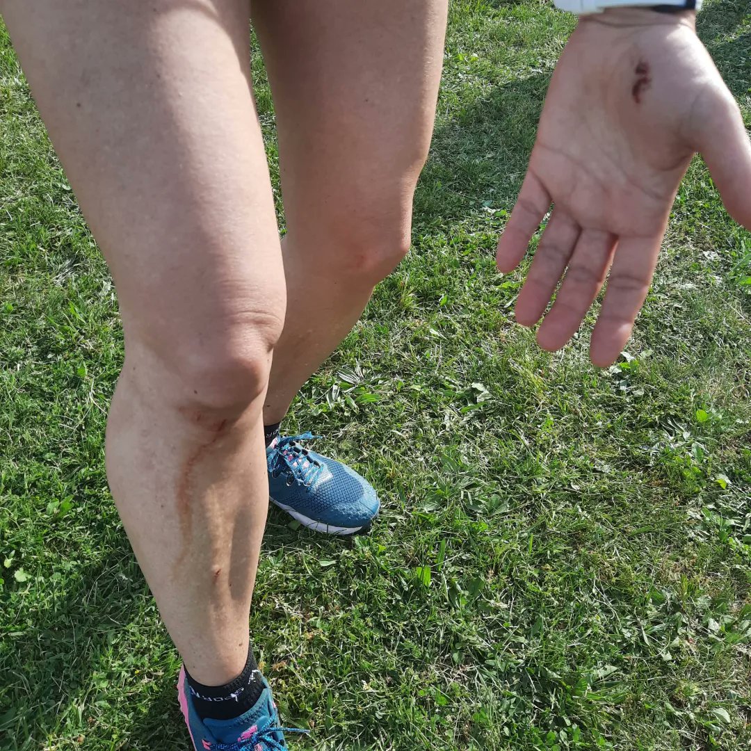 danisoriano70's tweet photo. DEBUT con mayúsculas de @06xesca en el trail Córrer pel Cor de la Fageda, ni la caida en el km 7 ni los 2 k extras han podido con ella! Grande cariño!
La segunda del finde!
#day592 x 2
#RunEveryDay
#metodosori
#RonhillSpain
#drinkingrunners #kmsxalimentos #nofunnorun
#mrfree https://t.co/2K2AwUBePn