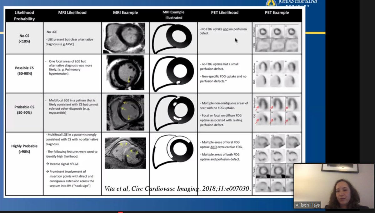 Antony Anandaraj (@antanee) on Twitter photo Cardiac Sarcoidosis at CMR <a href="/AllisonGHaysMD/">Allison G. Hays, MD</a>
#ACCEarlyCareer #IowaACCLectures
<a href="/ACCinTouch/">American College of Cardiology</a>
<a href="/SCMRorg/">Society for Cardiovascular Magnetic Resonance</a>
<a href="/Heart_SCCT/">Heart_SCCT</a> Cardiac Sarcoidosis at CMR <a href="/AllisonGHaysMD/">Allison G. Hays, MD</a>
#ACCEarlyCareer #IowaACCLectures
<a href="/ACCinTouch/">American College of Cardiology</a>
<a href="/SCMRorg/">Society for Cardiovascular Magnetic Resonance</a>
<a href="/Heart_SCCT/">Heart_SCCT</a>