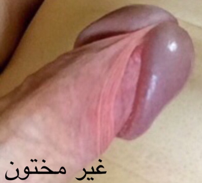 AnnCircanti's tweet photo. يحميك من الامراض الجنسية اذا زنيت وتبول وانت واقف وما تغسل ومافي فرق بين الاحساس (دراسة المشركين مثبته في الصحيحين) ! والله بيختبر المسلم صح خلق الانسان في احسن تقويم ولكن حديث الرسول سنة الختان اللي من صنع البشر اهم من القرآن ! https://t.co/3rAJb16pTI