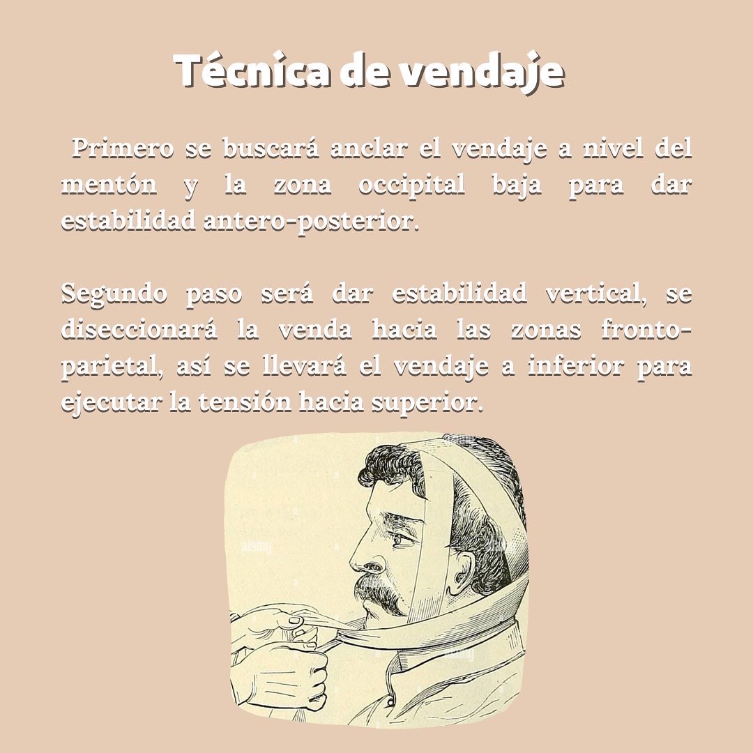 SEO_Unison's tweet photo. 🤕VENDAJE DE BARTON🤕

#OdontoBúhos https://t.co/0h3tYU6UaV
