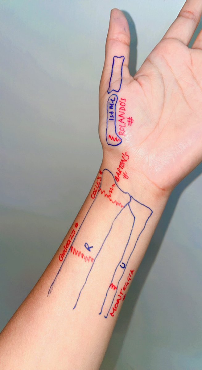 Thecrazydoc4's tweet image. Seems like the exam has got postponed for me😂 #NEETPG22 🙄