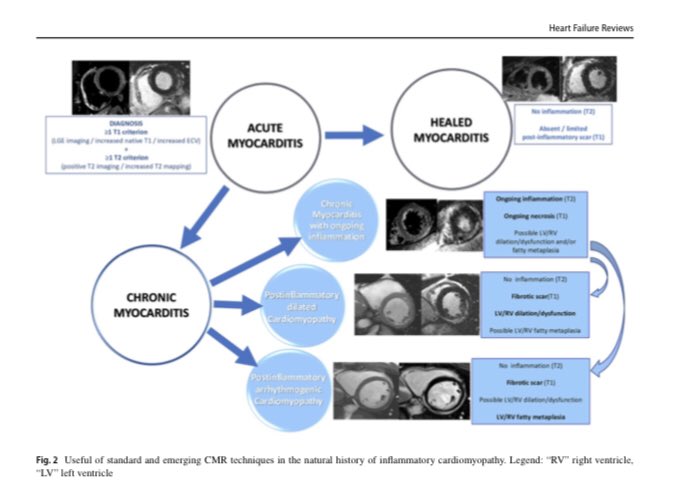 cardiopedhnn's tweet photo. https://t.co/M1AxFb4bZR

#cardiomyopathy #cardiac_imaging
#whyCMR https://t.co/4WS4TQH3x5