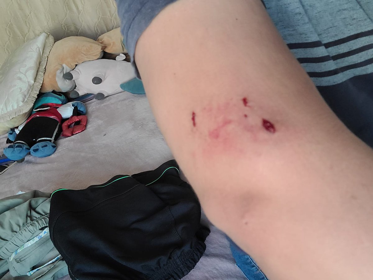 Ferchiz_VR's tweet photo. @Linea_Zapopan los perros de unos vecinos acaban de morder a mi novio mientras iba caminando en la acera, cómo podemos levantar una denuncia? Están en el patio con un hoyo en la reja y so perros bastante agresivos https://t.co/3LuiDa0EWp