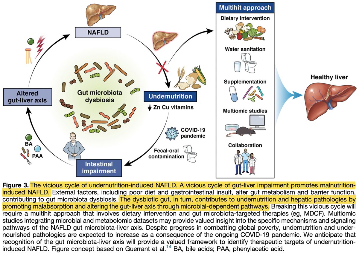 Juan Turnes (@jturnesv) on Twitter photo Tendemos a asociar el hígado graso a la obesidad y el síndrome metabólico, pero quizás sea algo más complejo
🤔 La malnutrición + alteraciones de la #microbiota también pueden causar #NAFLD 👉 ow.ly/p9rz50J8fla
✍️ <a href="/KCBSkope/">Dr. Kylynda C. Bauer, PhD</a> <a href="/FinlayLab/">Brett Finlay</a>
#livertwitter Tendemos a asociar el hígado graso a la obesidad y el síndrome metabólico, pero quizás sea algo más complejo
🤔 La malnutrición + alteraciones de la #microbiota también pueden causar #NAFLD 👉 ow.ly/p9rz50J8fla
✍️ <a href="/KCBSkope/">Dr. Kylynda C. Bauer, PhD</a> <a href="/FinlayLab/">Brett Finlay</a>
#livertwitter