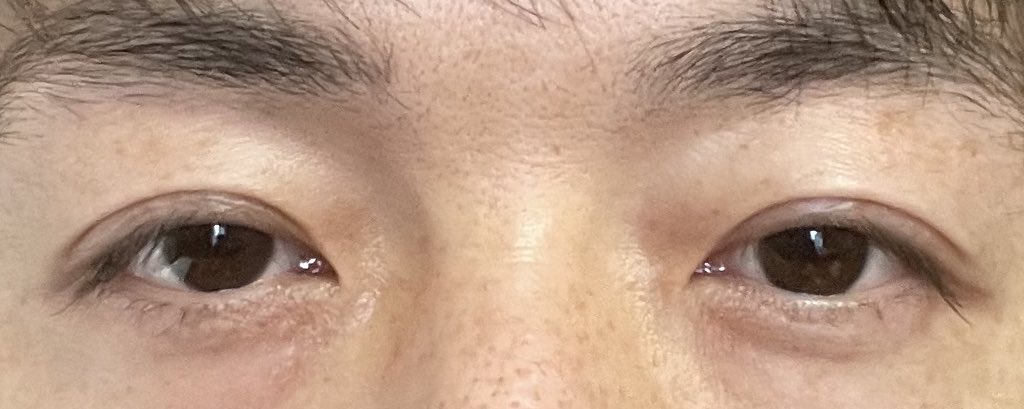 びよめんたる@美容男子アカウント tweet media