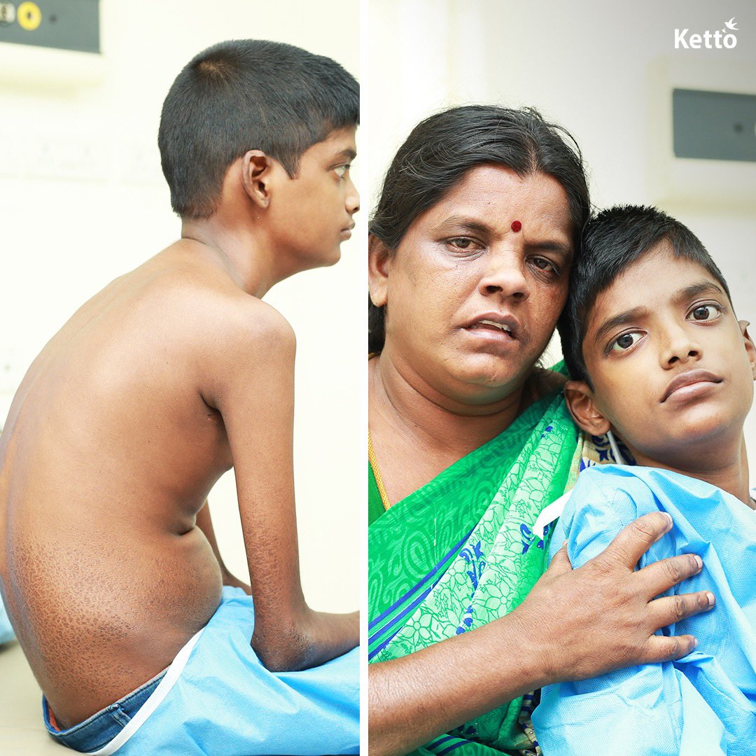 "A deadly disease has ruined my 14-yo son's life and reduced him to skin and bones. His health is going downhill with every passing day, and his only wish is to meet his favourite actor, #Vijay, before he undergoes a BMT.”

Please help: bit.ly/Save-Balaji_