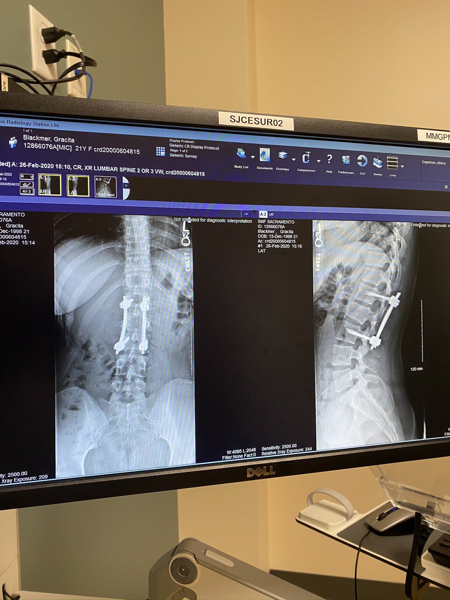 gracenasty_'s tweet photo. anytime a mf says they gonna break my back I’m like it’s already broken. what you gonna do now? https://t.co/SxbHI4FFIb