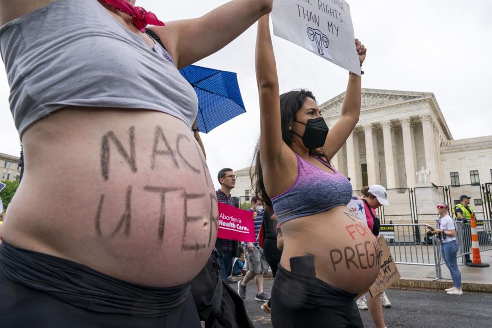 KristaBywater's tweet photo. Reproductive justice = human rights!
Abortion access = healthcare! #bansoffourbodies #prochoice #RoeVWade #WomensRights #ReproductiveRights #abortionishealthcare #MyBody https://t.co/e5HjXG7NeV