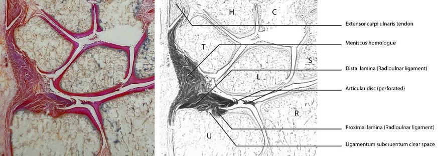 TFCC - The triangular fibrocartilage complex in the human wrist: A scoping review toward uniform and clinically relevant terminology 
onlinelibrary.wiley.com/doi/full/10.10…