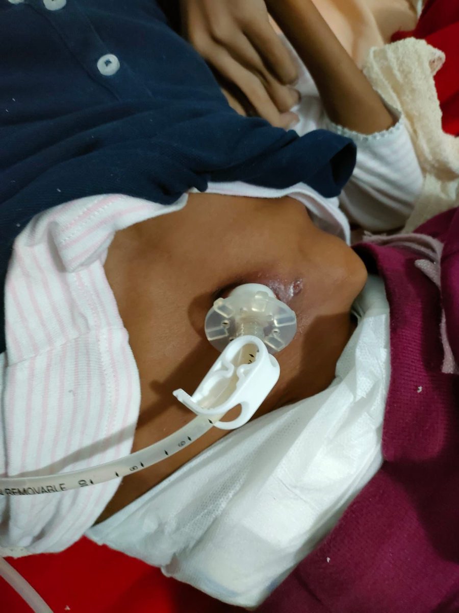 AdvoBarryRoux's tweet photo. This is Londiwe Mthethwa! Londiwe is Cerebral Palsy since birth. She was injured during birth. Londiwe’s parents fought the case against the Department of Health and won the case. https://t.co/3a7Ephx9ZS