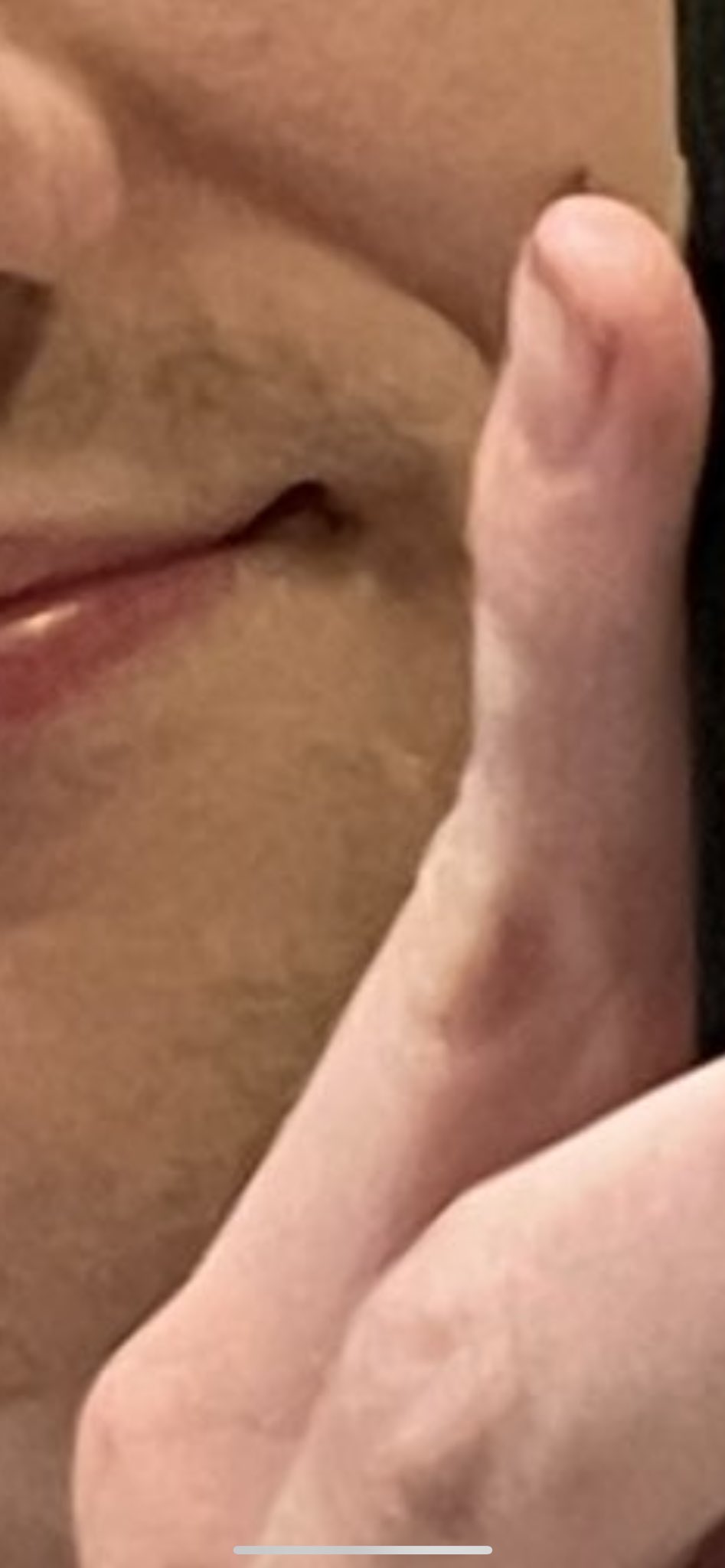 @matthwatson that finger is crazy https://t.co/upH9HpxK9S