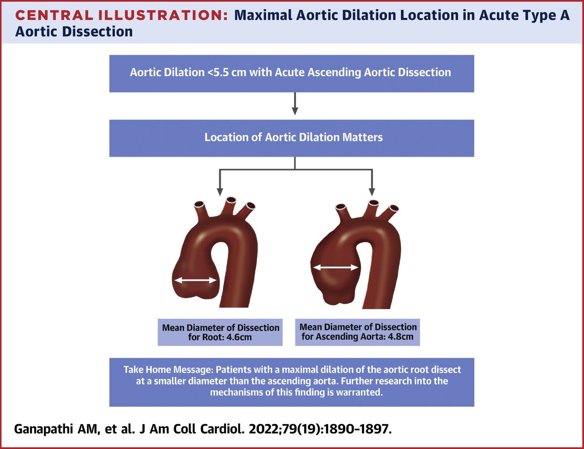 Does dissection occur at different diameters based on aortic location? See more on this important question on type A aortic dissection in #JACC: bit.ly/3l6c1E4

#CardioTwitter @MarkELindsay <a href="/keaglemd/">Kim Eagle</a>