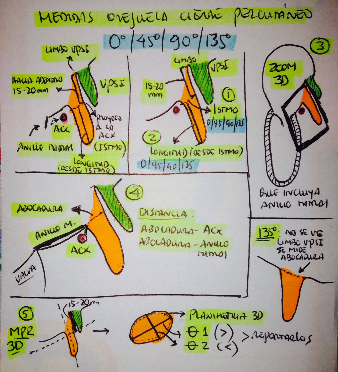 almasthela's tweet photo. #LAA assessment with #TOE for percutaneous closure 👁 (Watchman device)
Fast class in 1 📸 for #fellowfirst 🤓
PS: Özge sorry for my draw ✍️ @drzgezdentok1 https://t.co/rFdFJ5Aj3J