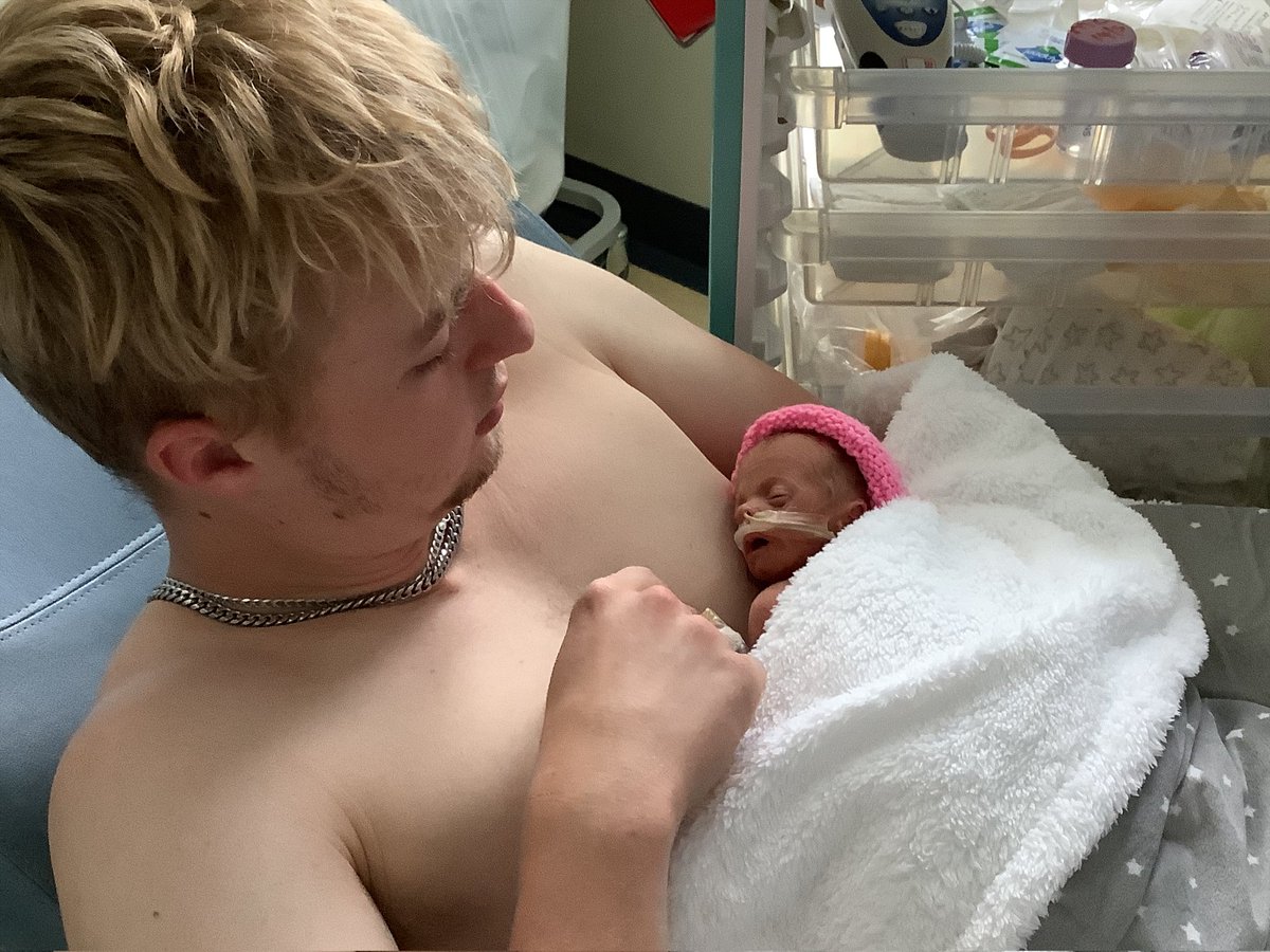 Happy world Kangaroo care awareness day 2022. Kangaroo care is something we strongly promote at Norfolk and Norwich. The benefits are endless for the most vulnerable of our patients. Permission gained to share this photo of one of our dads today. @nnuhjlch #kangaroocare @NNUH