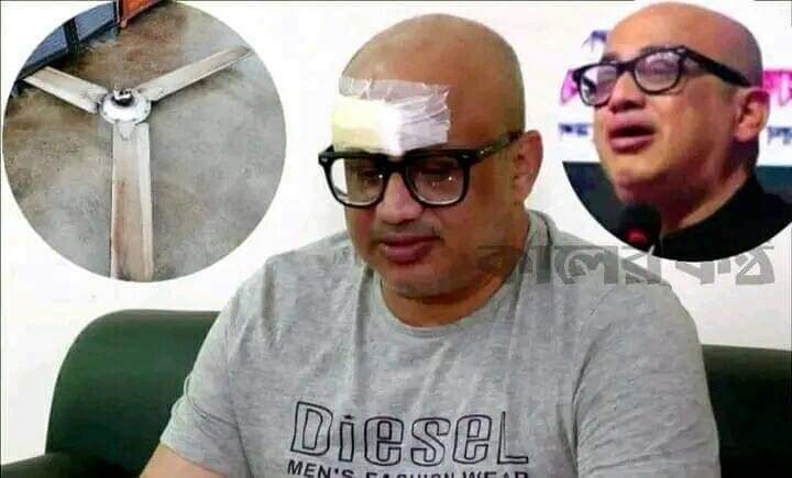 মুরাদের মাথায় তিনটা
 সেলাই লাগলেও
. ফ্যান সুস্থ আছে, 
আলহামদুলিল্লাহ!😜