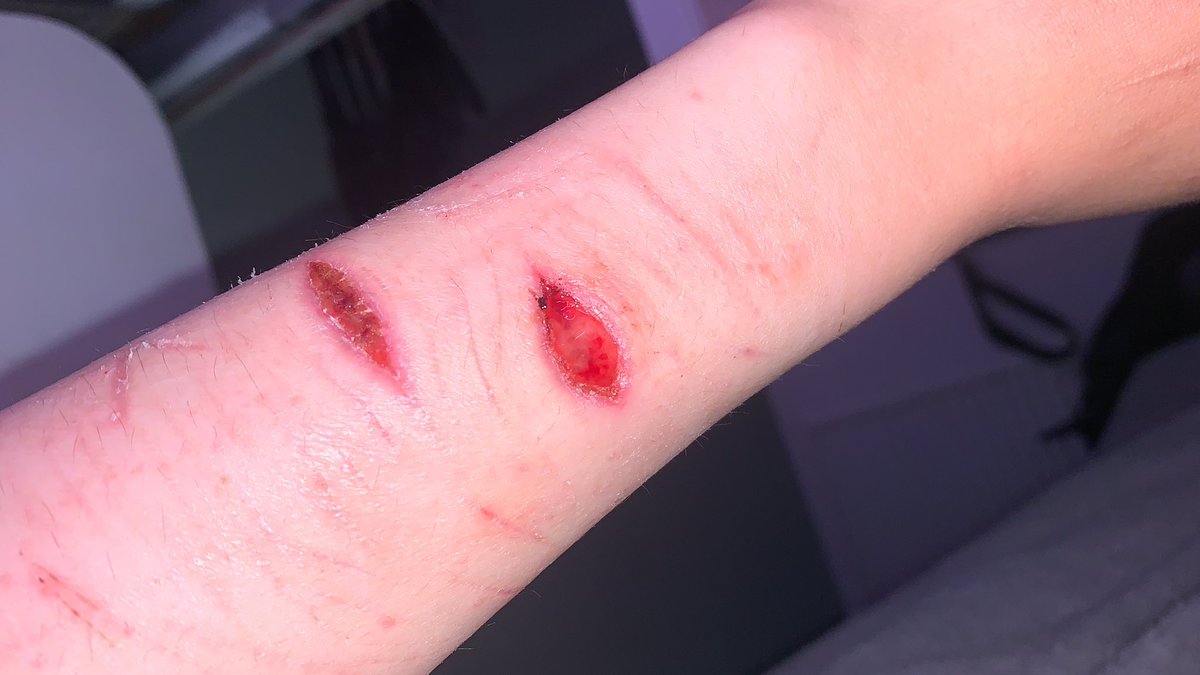 Styro_twt's tweet photo. Shtwt 99%sure infected ✌️ beanstwt https://t.co/GzQgoAky7U