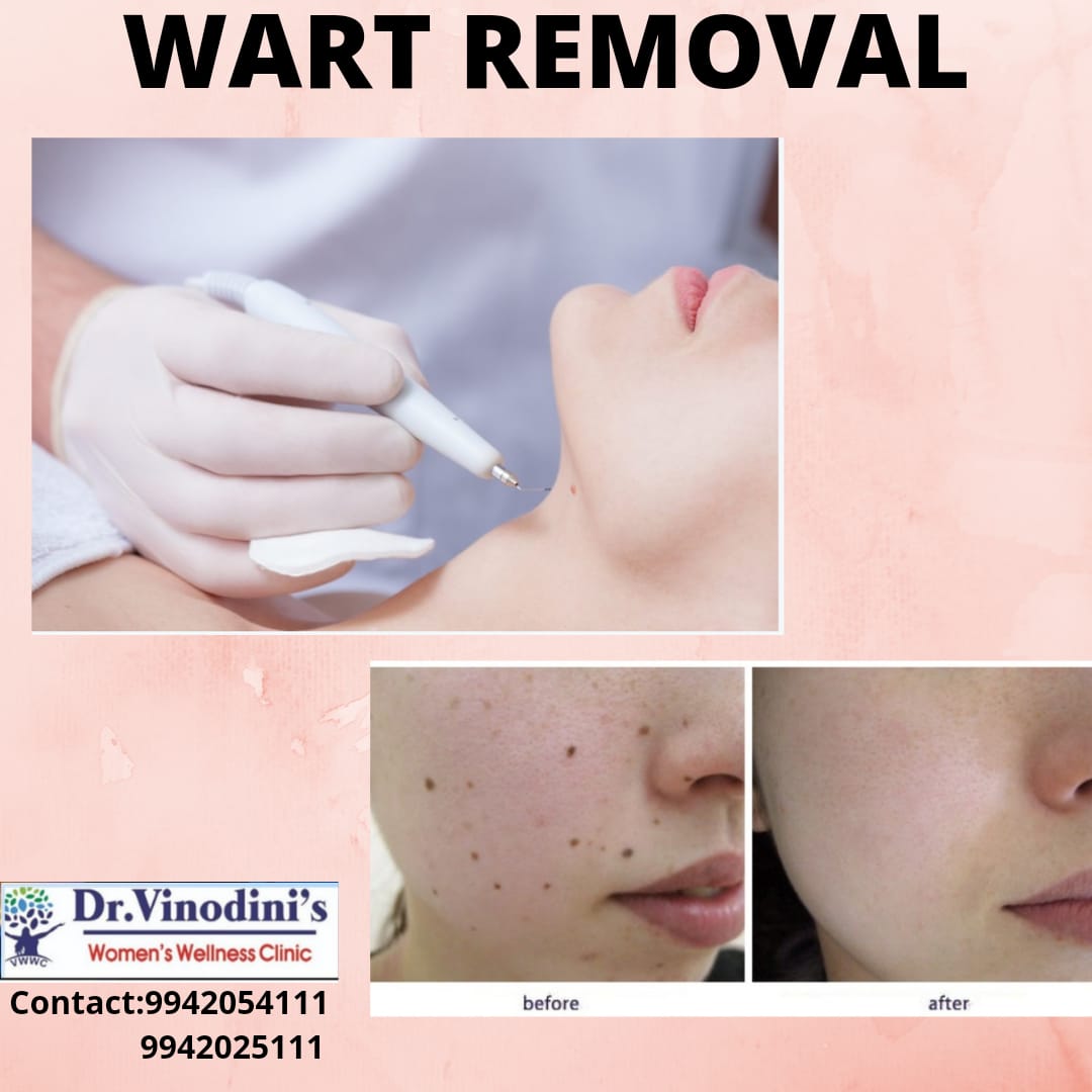 DrSolution's tweet photo. #drvinodinitanjavur #drvinodiniwomenswellnessclinic #drvh #cosmetology #trichology #skinwhitening #microblading #darklipcorrection #scarremoval #tattoremoval #chemicalpeel #lashlift #wartremoval 
For further details contact us 9942054111,9942025111 https://t.co/voTM8d9pNz