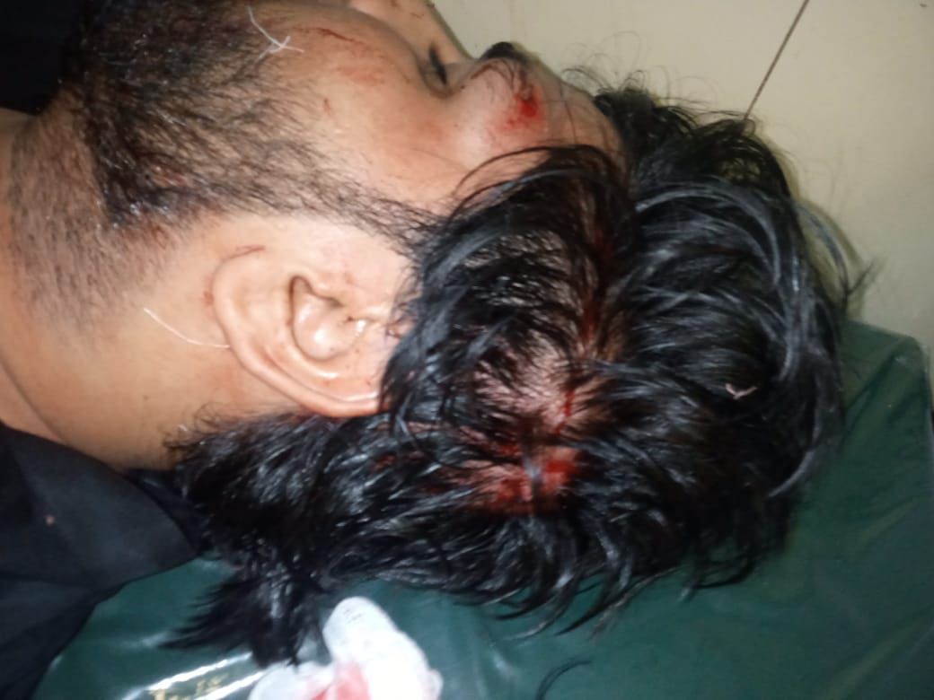 Arsalan_Raheem_'s tweet photo. We strongly condemns the attack on PSF JPMC unit workers by terrorist so called student organization.

PSF has never been and won't be pressurized by these coward acts.

We demand strict and jiffy action from @SindhGovtPak against the culprits.
#BanIJT 
#TerroristJamiat https://t.co/Zse220OXrc