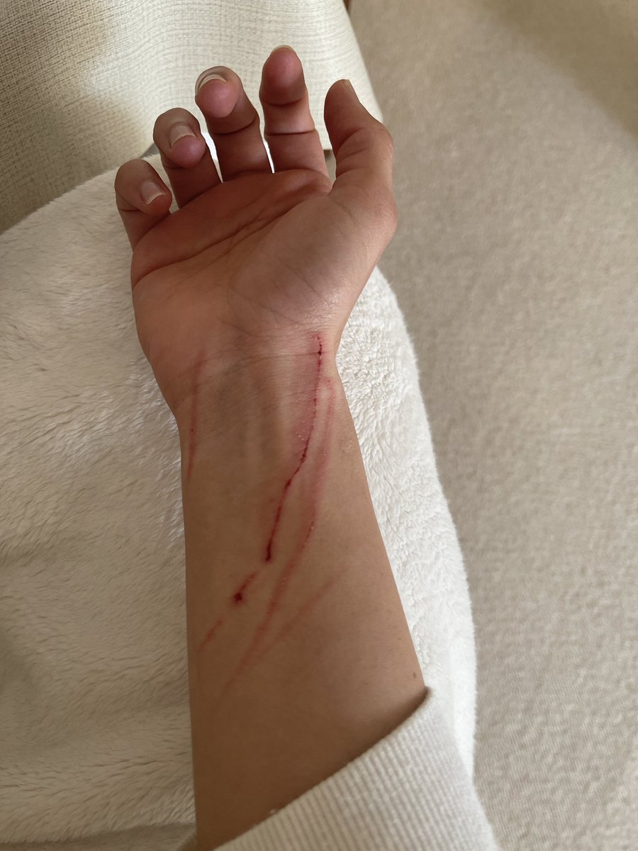 Nervous Cat + Movers coming = scratched me 😅 
Vet recommended an anti anxiety treatment starting soon, so on travel day he isn’t as scared. Let’s hope it works! #rescuecat #CatsOfTwitter #AdoptDontShop