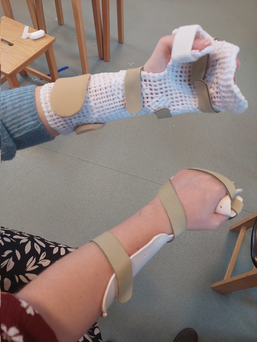 AlannahOT1's tweet photo. Making splints yesterday! 

#splint #OccupationalTherapy #handtherapy #occupationaltherapycpd @OTCumbria https://t.co/pa3PLIePIB
