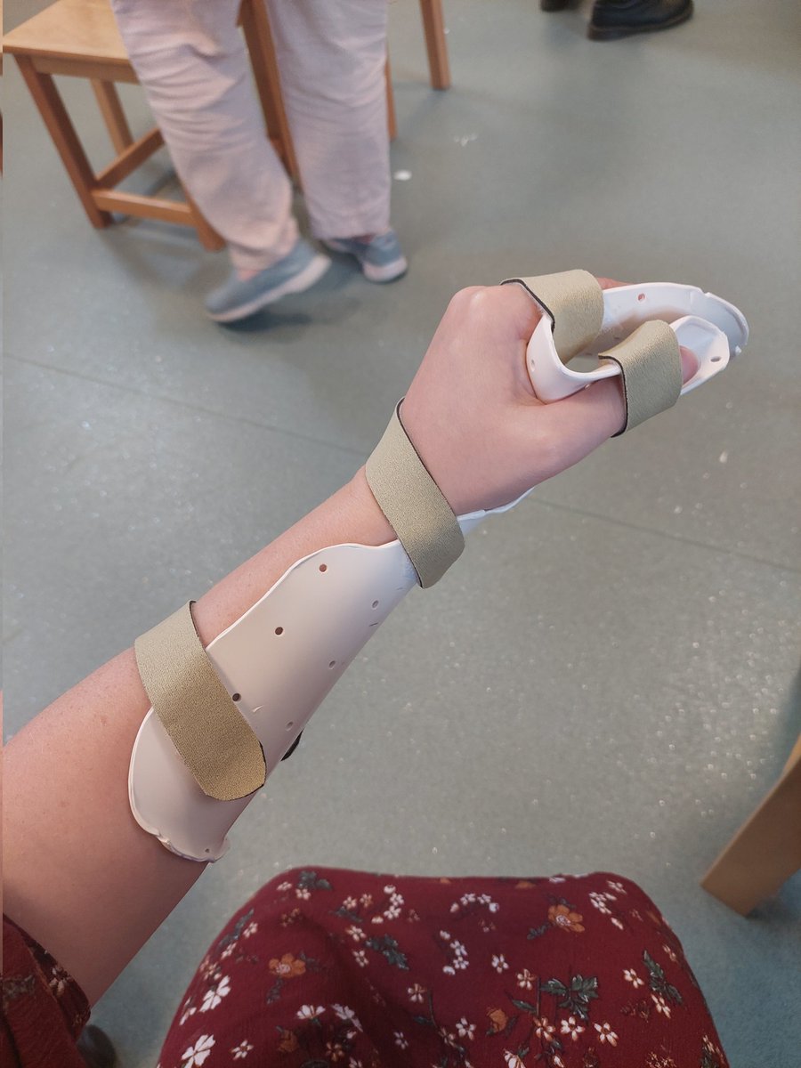 AlannahOT1's tweet photo. Making splints yesterday! 

#splint #OccupationalTherapy #handtherapy #occupationaltherapycpd @OTCumbria https://t.co/pa3PLIePIB