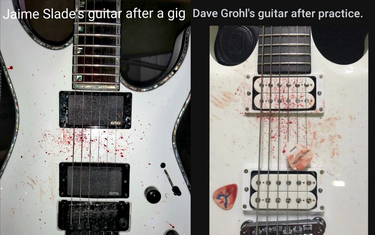DescendantsDark's tweet photo. When your guitarist splits their thumb open on song 2 of a 3 hour gig and is so hard core they carry on and manage 4 encores 🤘🤘
#guitar #guitarist #davegrohl #hardcorepunk #Metal #metalfamily https://t.co/NQKBHwq4Xi