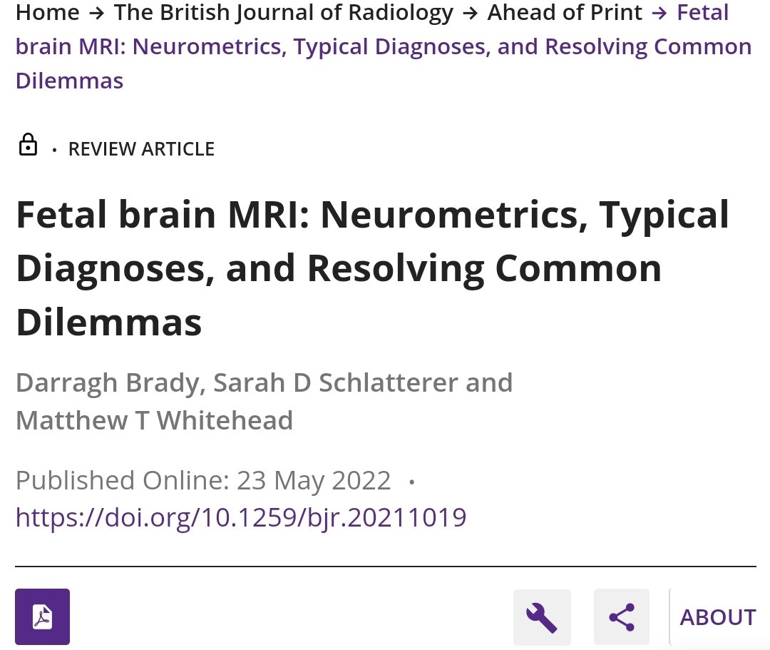 Agenesis of the corpus callosum tweet media