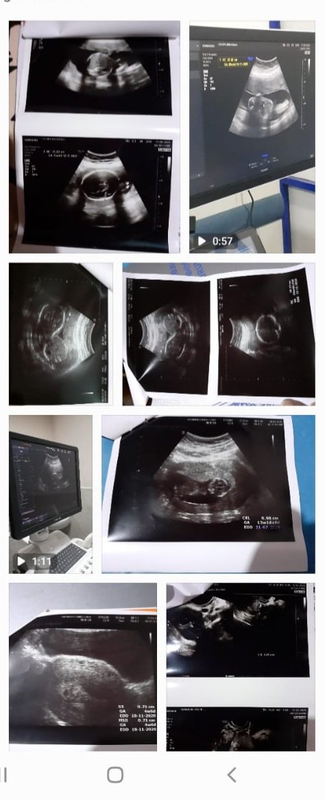 Sudeepa10749's tweet image. ජීවිතේ වැඩියෙන්ම සතුටු උන අවස්ථා කීපයක්.
#Roben baba