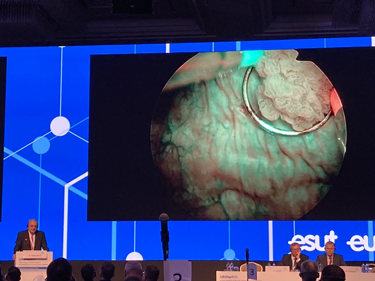 OlympusUrology's tweet photo. Goodbye #UROTech22 🇹🇷! Thank you for the organisation and interesting scientific program. The surgery & thematic sessions covered a wide range of topics in #urology and we especially enjoyed the personal exchange and discussions. See you soon on the #EAU22 in Amsterdam! @Uroweb https://t.co/uMHiIG2fRD
