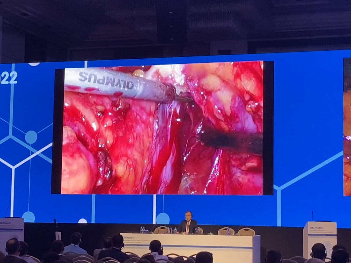 OlympusUrology's tweet photo. Goodbye #UROTech22 🇹🇷! Thank you for the organisation and interesting scientific program. The surgery & thematic sessions covered a wide range of topics in #urology and we especially enjoyed the personal exchange and discussions. See you soon on the #EAU22 in Amsterdam! @Uroweb https://t.co/uMHiIG2fRD