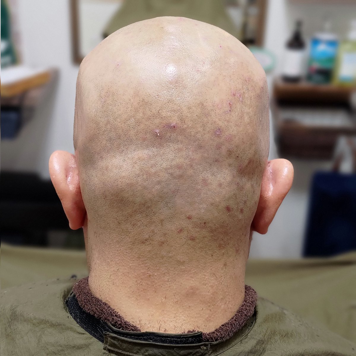 bb_furusawa's tweet image. 理容フルサワの神々しさをご希望いただき千葉からのご来店。

目指すはどの方向から撫でてもザラつかない肌触り。球体で凹凸もあるから難しいのですが。

とにかく完璧目指してひたすら剃る。これがまた楽しいんだな💈

#剃髪 #スキンヘッド #tonsure #剪发 #shaving 
#神々しきスキンヘッド