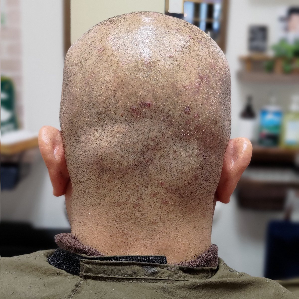 bb_furusawa's tweet image. 理容フルサワの神々しさをご希望いただき千葉からのご来店。

目指すはどの方向から撫でてもザラつかない肌触り。球体で凹凸もあるから難しいのですが。

とにかく完璧目指してひたすら剃る。これがまた楽しいんだな💈

#剃髪 #スキンヘッド #tonsure #剪发 #shaving 
#神々しきスキンヘッド