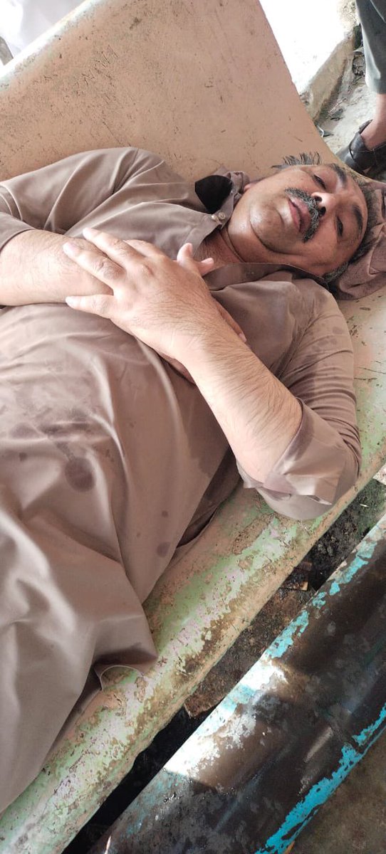 DrSeemaSZia's tweet photo. @PTIofficial Twice tear gas was fired and burst on the face of MPA Sindh Shah Nawaz Jadoon. He inhaled too much gas and heart started sinking &amp; BP dropped and was rushed to hosp and was admitted for a day https://t.co/sfou08i5ee