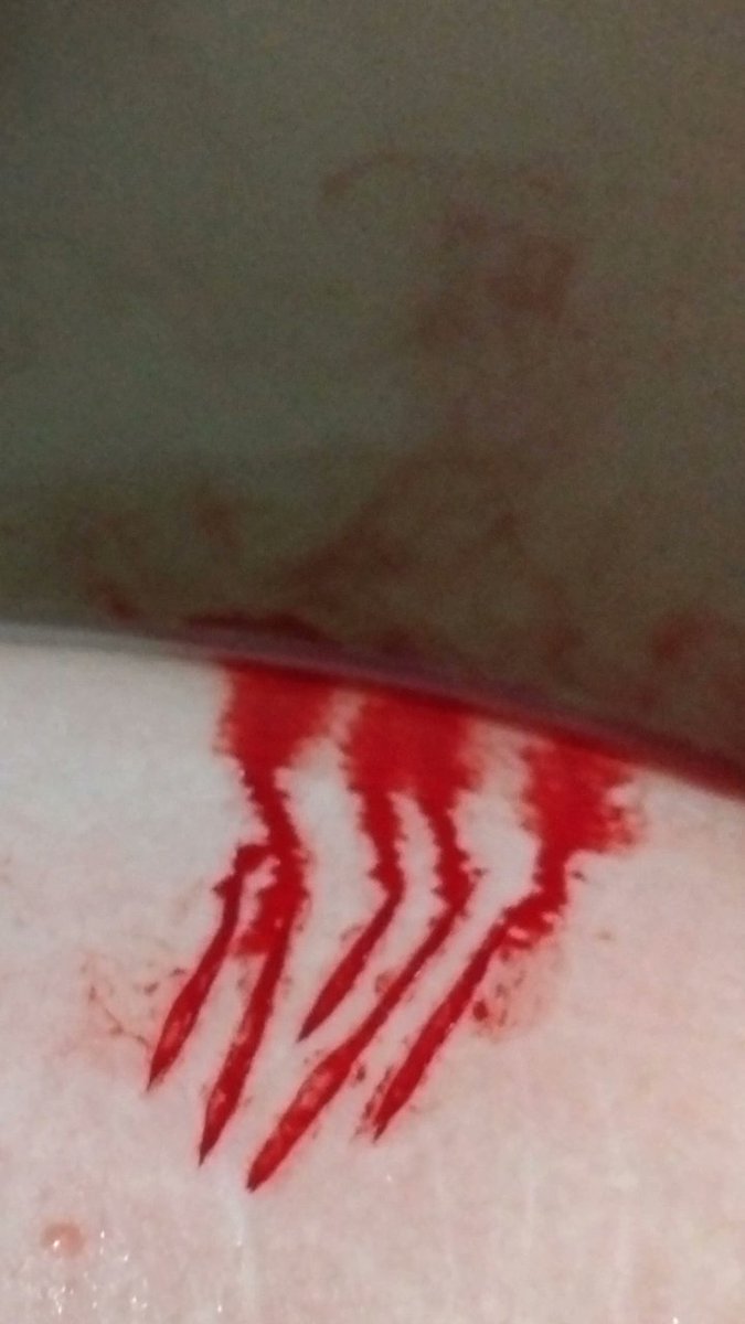 idk_how2cope's tweet photo. TW s3lfh4rm
Last night
.
.
.
.
.
.
.
shtwt armgillstwt styrotwt catscratchtwt https://t.co/JReWJlgUlh
