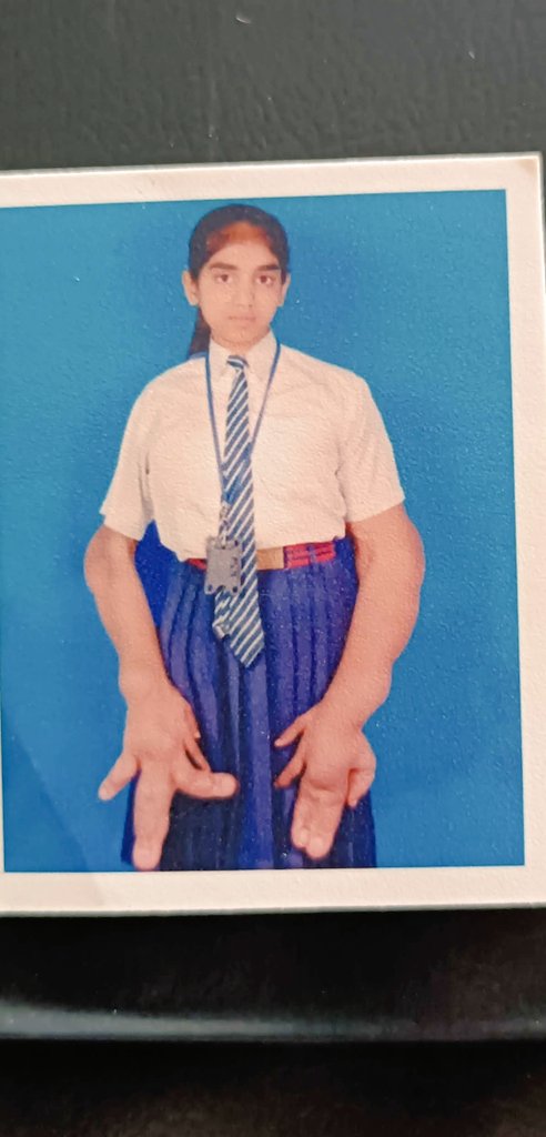 gangwarkaran56's tweet photo. @SonuSood नमस्ते Sir जी 🙏 यह मेरी सबसे अच्छी दोस्त नूरी है मैं चाहता हूं मेरी दोस्त के हाथ ठीक हो जाए दुआ और दवा से पर सिर्फ दुआ से संभव नहीं और इलाज के लिए मैं इतना सक्षम नहीं हूं अभी प्लीज Sir मेरी प्यारी सी दोस्त की मदद करे, उम्मीद की किरण को साकार करे 🙏🙏. https://t.co/RobIMSd4qB