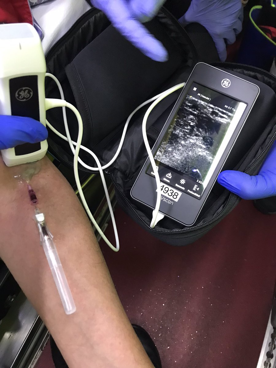 Mejorando la asistencia, aumentando capacidades. Canalización venosa ecoguiada en emergencias #samur #ecografia #POCUS #enfermería #emergencias #vscan