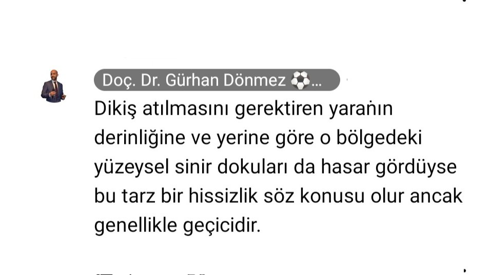 Adem'in bacağındaki hissizlik sonucu endişemizi Çok Kıymetli Doç.Dr.Gürhan Dönmez Hocamızla paylaştım,tarafıma beyan ettiği değerli bilgisini sizlerle paylaşıyorum #akfc ailem:

#AdemKılıçcı 
#AKFC