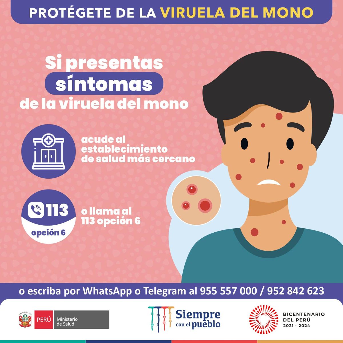 Minsa_Peru's tweet photo. 🤓 Conoce un poco más sobre los síntomas, características y recomendaciones para protegerte contra la viruela del mono. Si necesitas más información puedes llamar gratis a la línea 113 opción 6. 📲 https://t.co/bD7DASwtsv