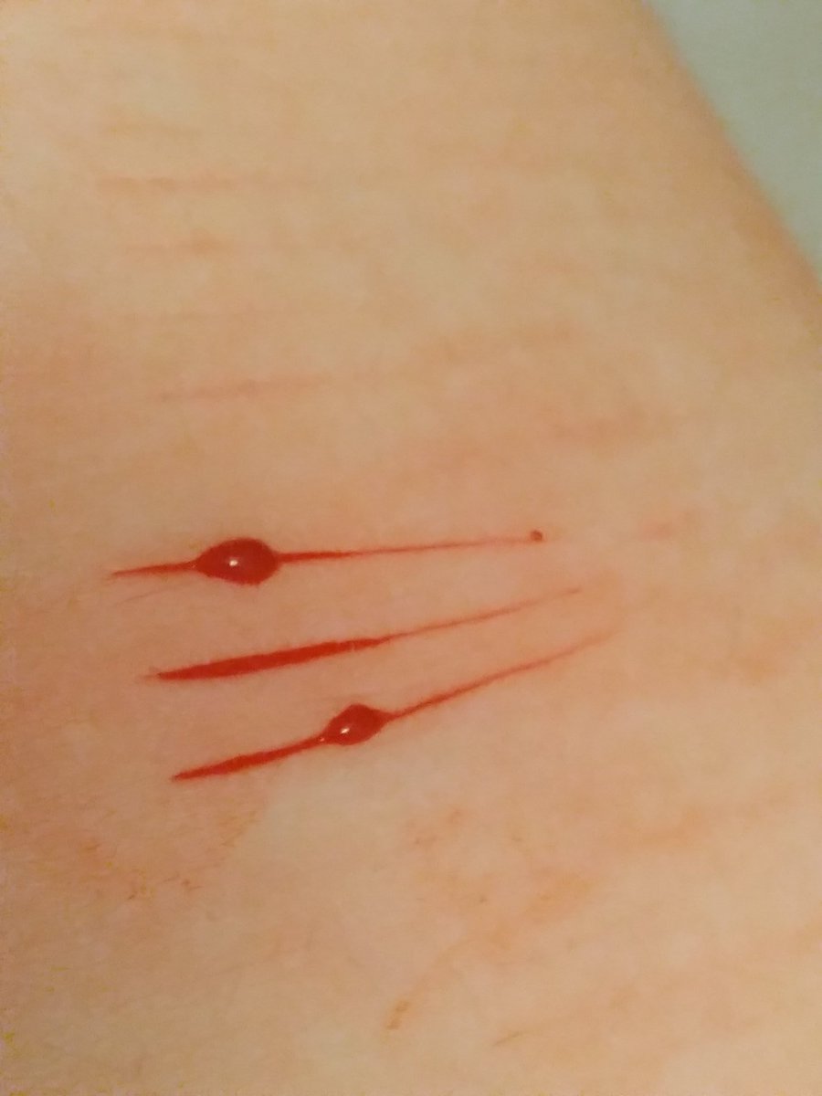 toxicblazers's tweet photo. havent been able to pozt that much since i keep getting my phone taken lolz

shtwt bloodtwt styrotwt ouchietwt barcodetwt 198twt raspberryfillingtwt catscratchtwt sliceytwt yeettwt https://t.co/HIB5b7W8xH