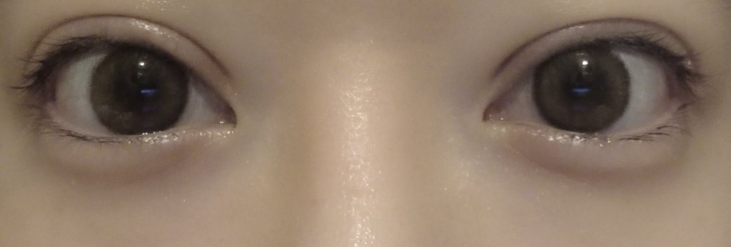 testuser_000's tweet image. 二重切開再手術から
おおよそDT１ヶ月
満足がいく仕上がりになって
安心した😭🧡
まだぷっくり腫れてます🫥