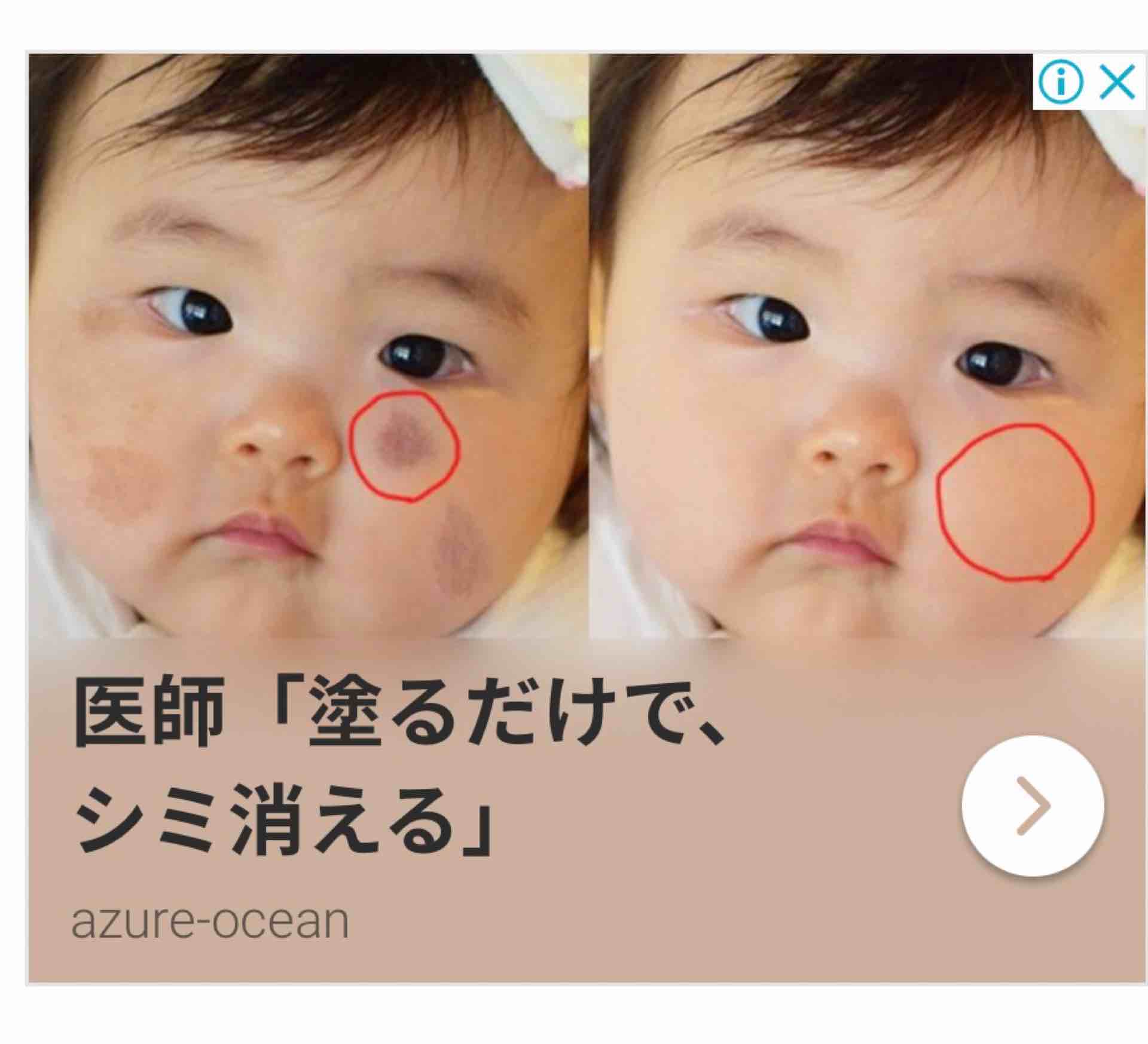 ますたー こういう広告やたら出ててうざいけど これに関してはアホすぎて笑ってしまった 綺麗な肌をafterにしたいな そうだ 赤ちゃんなら肌めっちゃきれいだ という結果に囚われてしまって赤ちゃんにシミを描くbeforeを作ってしまったんだろうな