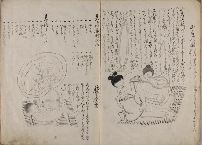 『孕家発蒙図解』(1851年・京都大学富士川文庫蔵)は悪阻から始まり産前産後や、出産の態勢、双子が胎内でどのような状態か、逆子の時は腹の形は通常とどのように異なるかを図とともに説明してある書物。誤った知識により難産を経験する女性を減らすために記されたようです。 