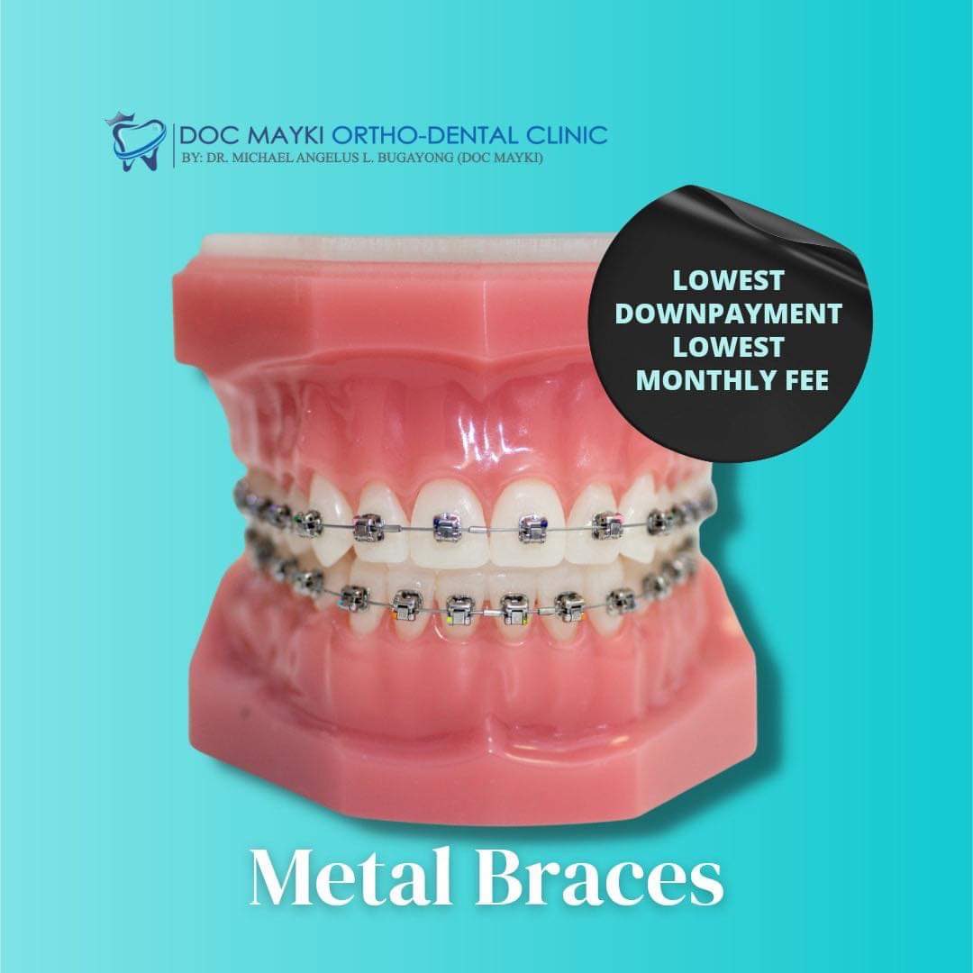 Michael angelus Bugayong (@angelusbugayong) on Twitter photo 