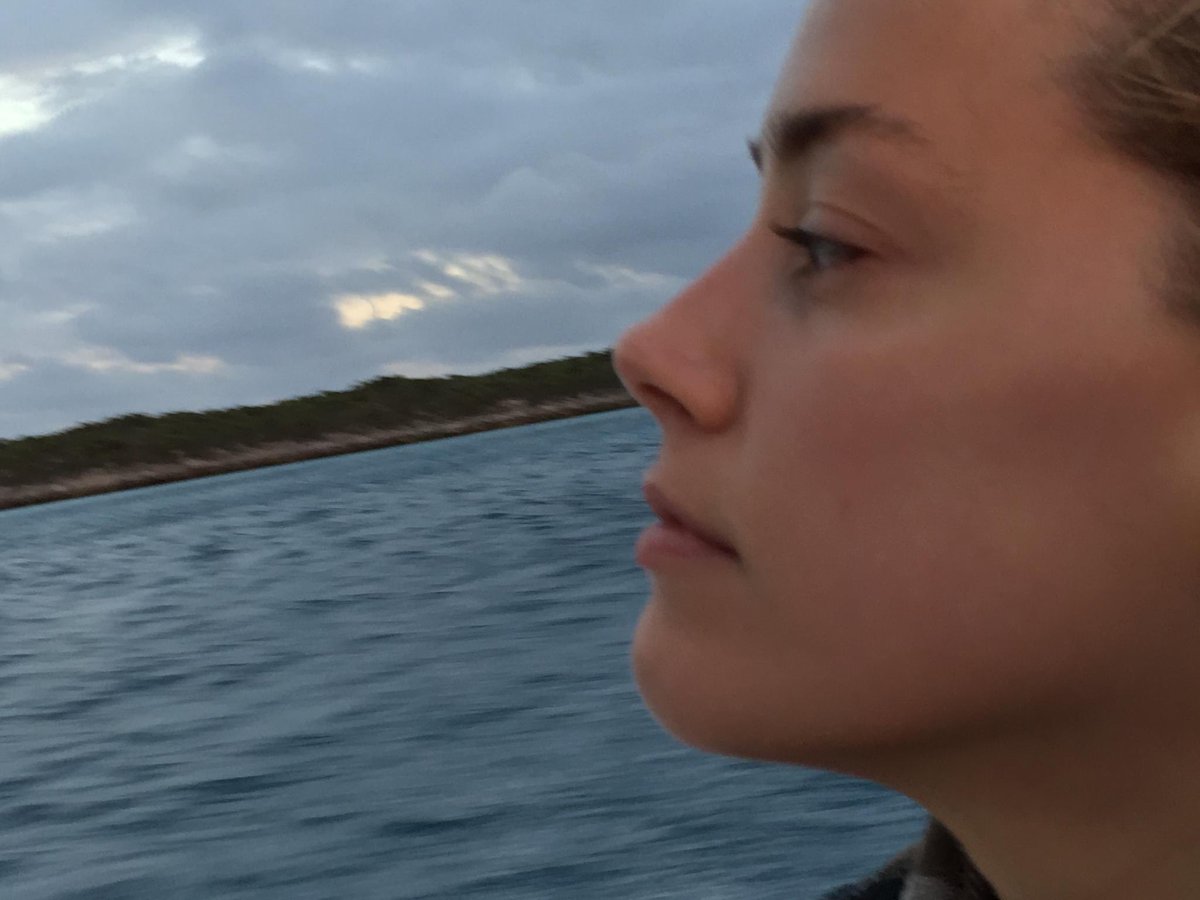 SuperDopeJax's tweet photo. I mean just look at the absolute carnage on her face in the Bahamas from December 2015. https://t.co/7ThQGXEJqA
