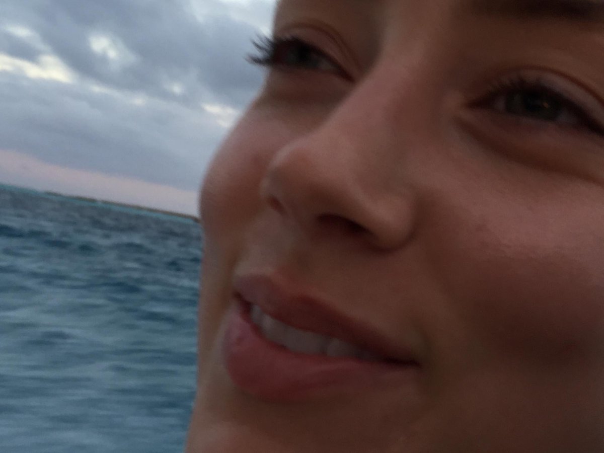 SuperDopeJax's tweet photo. I mean just look at the absolute carnage on her face in the Bahamas from December 2015. https://t.co/7ThQGXEJqA