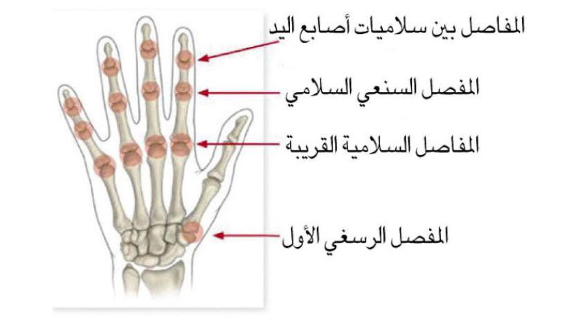 CAM (@cam_medicine) on Twitter photo مقال: خطوات طبية لعلاج آلام اليد 🩺 هارفارد
aawsat.com/node/3668426
-
@ho88_sh <a href="/SpxcRTs/">SpxcRTs</a> <a href="/ScrimFinder/">Scrim Finder</a> <a href="/TwitchHostings/">TwitchHostings</a> #supportsmallstreamers #HarvardHealth #صوت_الطبيب
#فضفضة_طبيب #اطباء_العالم
اذا كنت مقتنعًا بالتغريدة لايك ❤️و ريتويت🔄 تابعني ⬅️ أتابعك 😇✋️🙏وفعل الجرس 🔔 مقال: خطوات طبية لعلاج آلام اليد 🩺 هارفارد
aawsat.com/node/3668426
-
@ho88_sh <a href="/SpxcRTs/">SpxcRTs</a> <a href="/ScrimFinder/">Scrim Finder</a> <a href="/TwitchHostings/">TwitchHostings</a> #supportsmallstreamers #HarvardHealth #صوت_الطبيب
#فضفضة_طبيب #اطباء_العالم
اذا كنت مقتنعًا بالتغريدة لايك ❤️و ريتويت🔄 تابعني ⬅️ أتابعك 😇✋️🙏وفعل الجرس 🔔