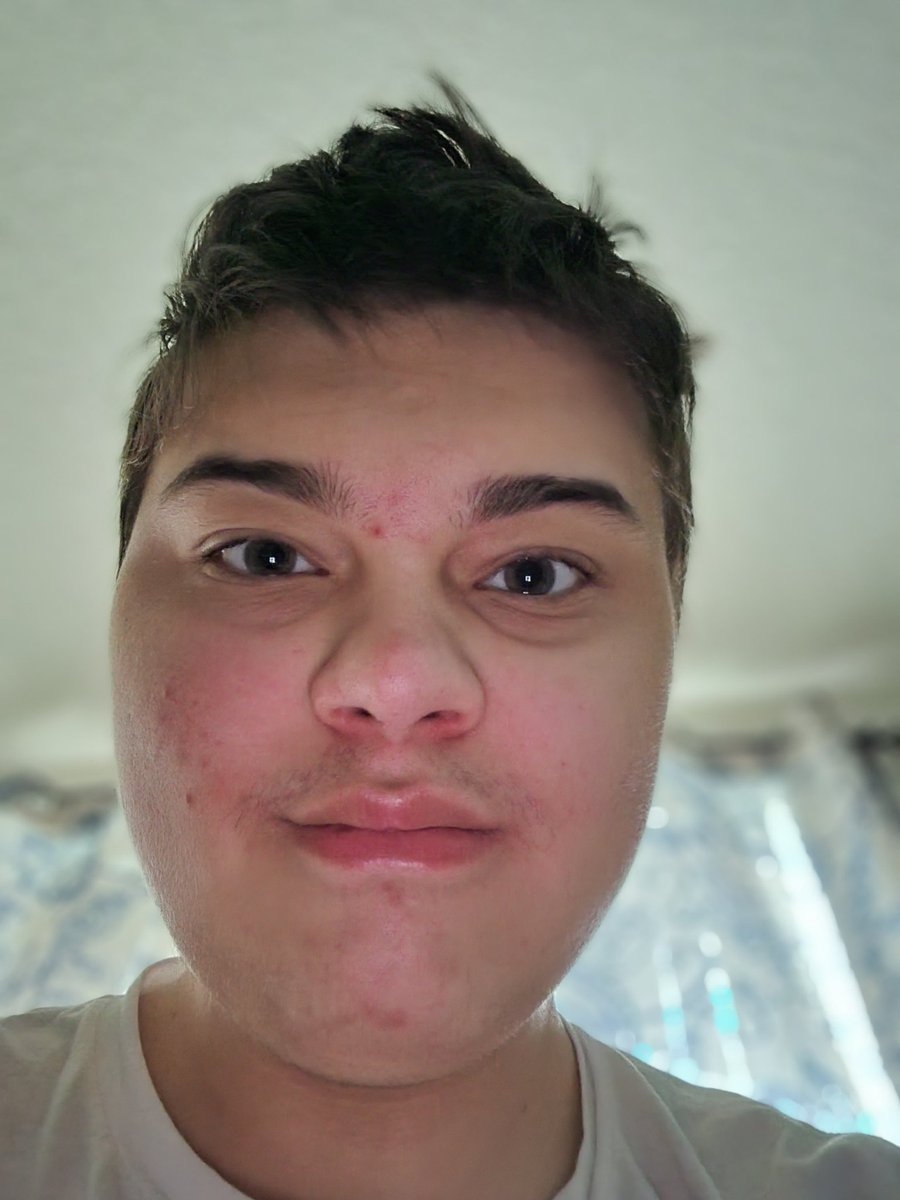 cakes_long's tweet photo. Just woke up from party how do i look https://t.co/9njIcdP0mm