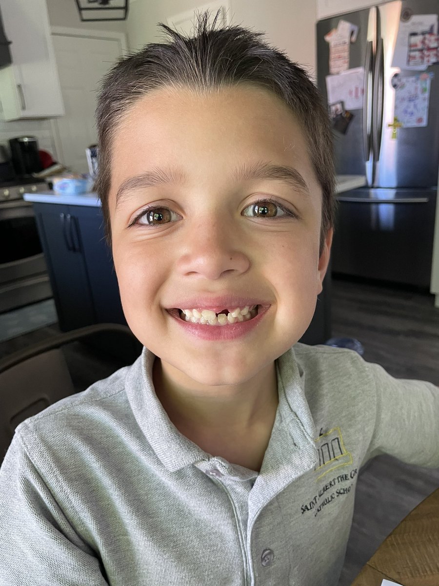 YakoKristina's tweet image. Big. News. #fronttooth