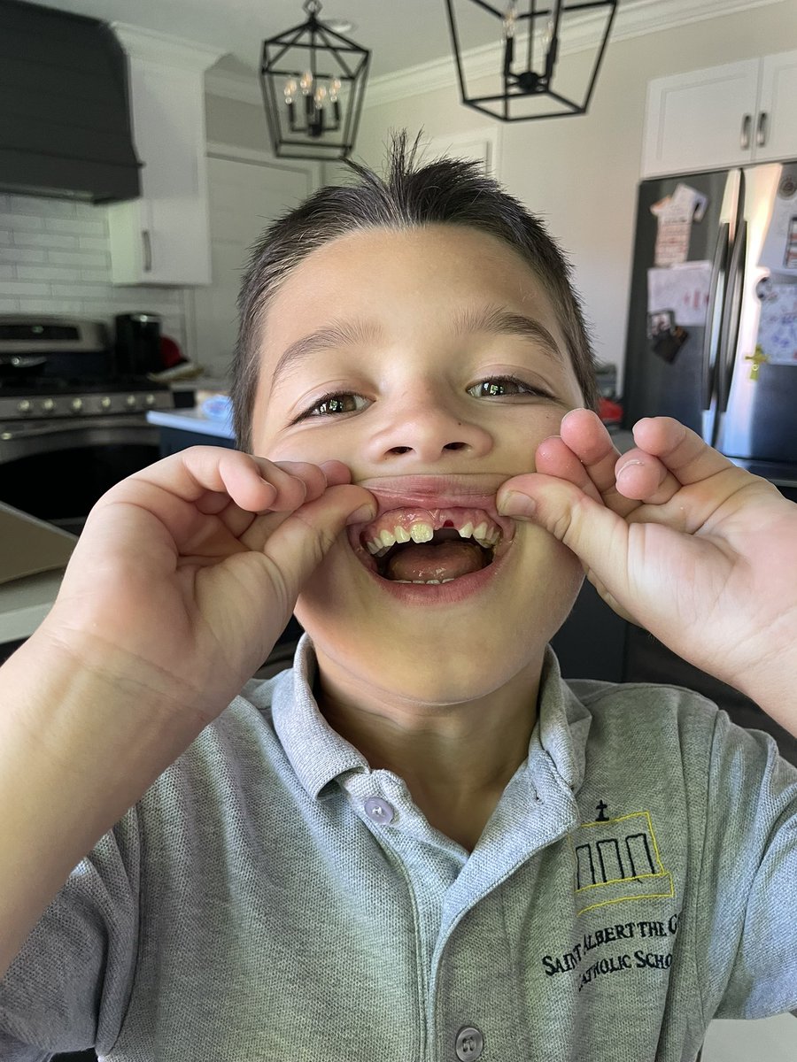 YakoKristina's tweet image. Big. News. #fronttooth